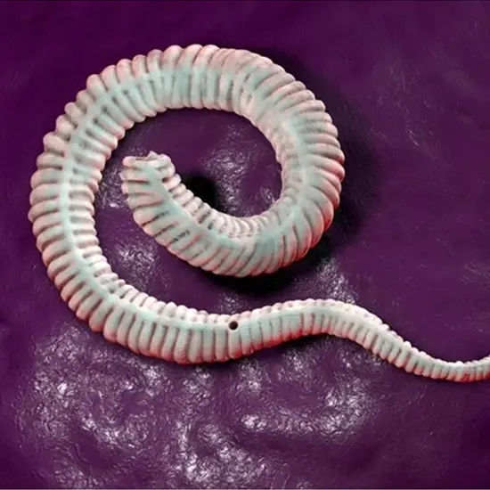 A Worm That Plagued Humanity For Years : Dracunculus Medinensis